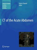 CT of the Acute Abdomen - MPHOnline.com