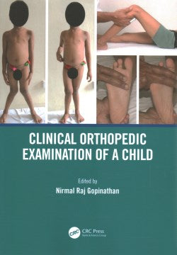 Clinical Orthopedic Examination of a Child - MPHOnline.com