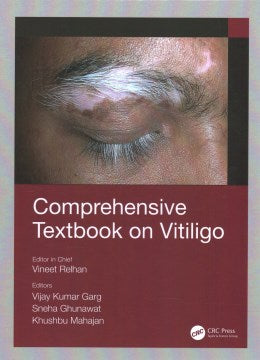 Comprehensive Textbook on Vitiligo - MPHOnline.com