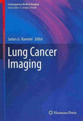 Lung Cancer Imaging - MPHOnline.com