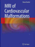 MRI of Cardiovascular Malformations - MPHOnline.com