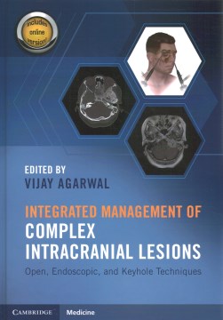 Integrated Management of Complex Intracranial Lesions - MPHOnline.com