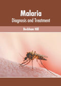 Malaria - MPHOnline.com