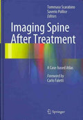 Imaging Spine After Treatment - MPHOnline.com