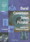 Dural Cavernous Sinus Fistulas - MPHOnline.com