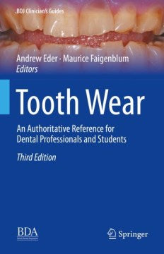 Tooth Wear - MPHOnline.com