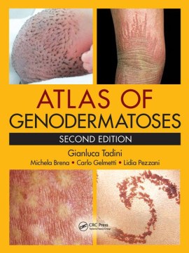 Atlas of Genodermatoses - MPHOnline.com