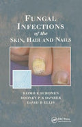 Fungal Infections of the Skin, Hair and Nails - MPHOnline.com