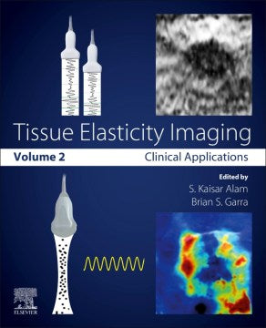 Tissue Elasticity Imaging - MPHOnline.com