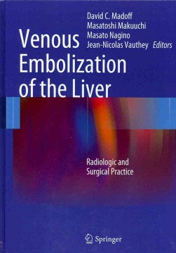 Venous Embolization of the Liver - MPHOnline.com