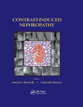 Contrast-Induced Nephropathy - MPHOnline.com