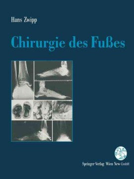 Chirurgie Des Fu?es - MPHOnline.com