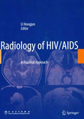 Radiology of HIV/AIDS - MPHOnline.com