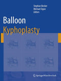 Balloon Kyphoplasty - MPHOnline.com