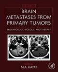 Brain Metastases from Primary Tumors - MPHOnline.com