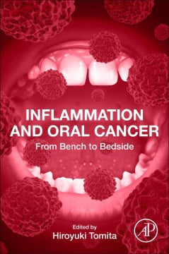 Inflammation and Oral Cancer - MPHOnline.com