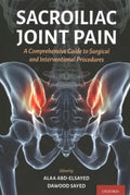 Sacroiliac Joint Pain - MPHOnline.com