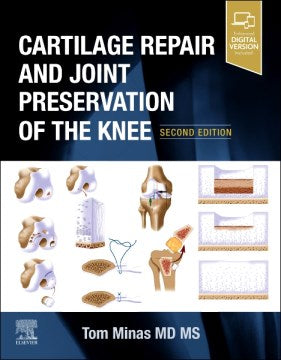 Cartilage Repair and Joint Preservation of the Knee - MPHOnline.com