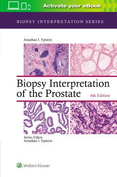 Biopsy Interpretation of the Prostate - MPHOnline.com