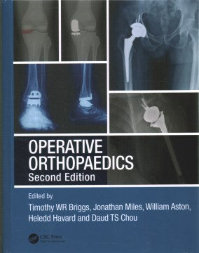 Operative Orthopaedics - MPHOnline.com