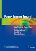 Bone Tumor Imaging - MPHOnline.com