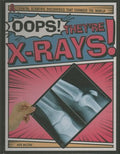 Oops! They're X-rays! - MPHOnline.com