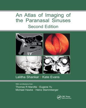 Atlas of Imaging of the Paranasal Sinuses - MPHOnline.com