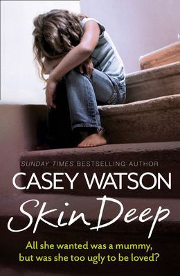 Skin Deep: All She Wanted was a Mummy, But Was She Too Ugly to be Loved? - MPHOnline.com