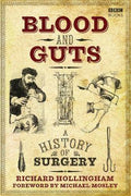 Blood And Guts: A History Of Surgery - MPHOnline.com